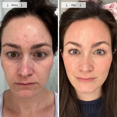 Omnilux Contour Face