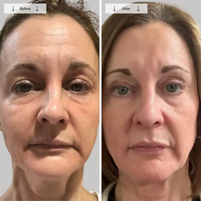 Omnilux Contour Face