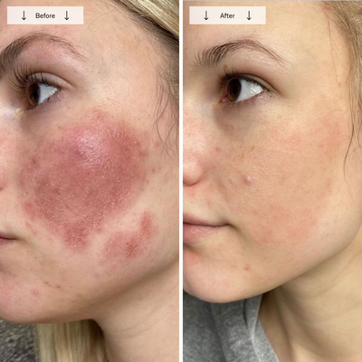 Omnilux Contour Face