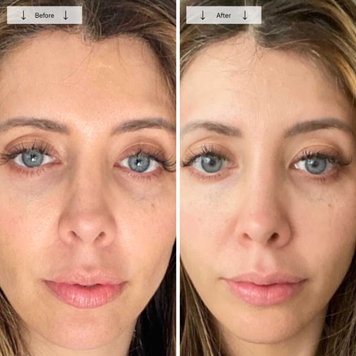 Omnilux Contour Face