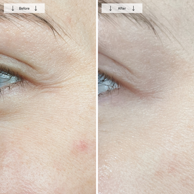 Omnilux Contour Face